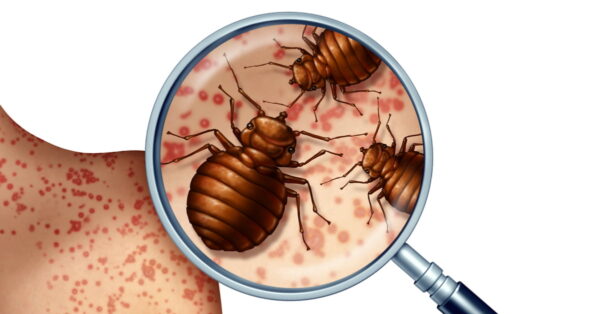 Servants' Quarters Bed Bug Control